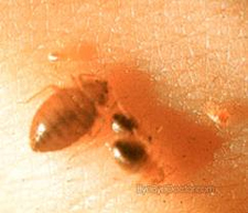 Kill Bed Bugs in Silver Spring/ Kill Bed Bugs Silver Spring, Maryland